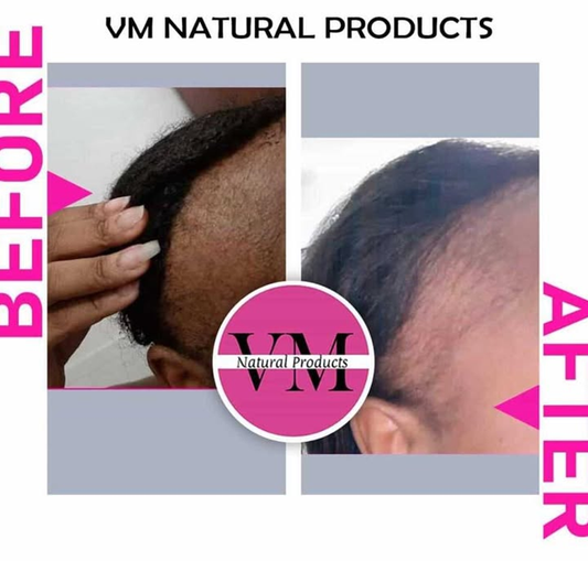 Ras'Tafari Hair Growth Oil